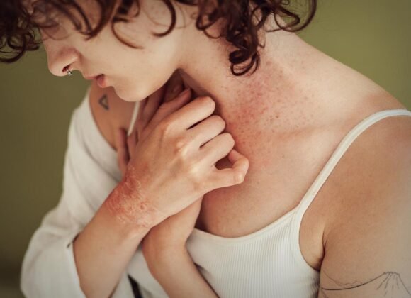 Early Signs of Eczema: What to Look For and Treat Early Person with curly hair shows a red, itchy rash on their neck and hands while wearing a white tank top, highlighting the importance of eczema prevention.