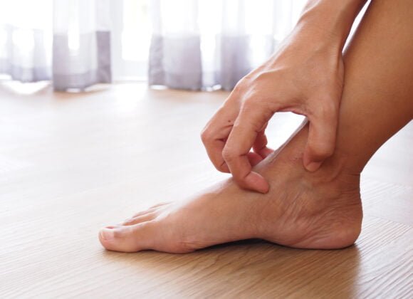 Foot Eczema: Causes, Symptoms, and Footwear Tips A person scratches the inner side of their right ankle, struggling with dry patches, while seated on a wooden floor near a window with sheer curtains.