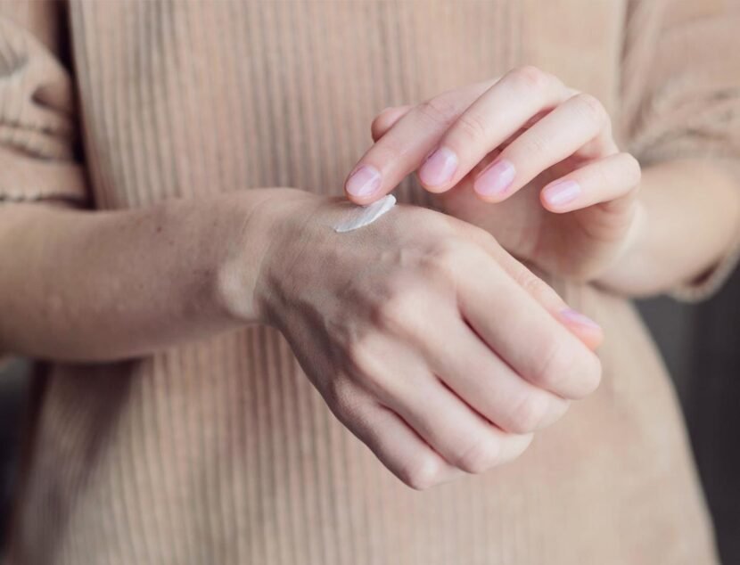 Hand Eczema Symptoms: How It Affects Daily Activities A person applies a dab of cream to the back of their hand.