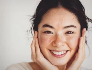 Close-up of a woman smiling with her hands framing her face, featuring freckles on her nose and cheeks. She has dark hair pulled back, radiating confidence after discovering eczema treatment that has brought significant relief.