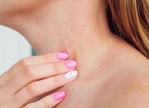 Neck Eczema: Symptoms and Triggers to Watch For Close-up of a person touching their neck, with pink manicured nails and a heart design on the ring finger, possibly due to itchy skin.