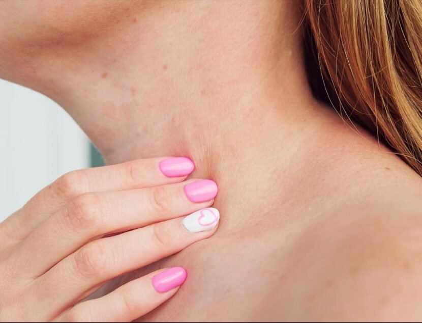Neck Eczema: Symptoms and Triggers to Watch For Close-up of a person touching their neck, with pink manicured nails and a heart design on the ring finger, possibly due to itchy skin.