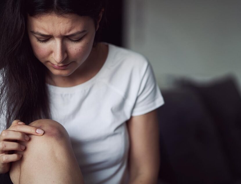 How to Stop Nighttime Itching from Eczema Symptoms A woman with long dark hair wearing a white shirt looks at a bruise on her knee.