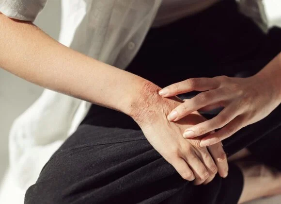 A person examines their forearm, which shows signs of irritation and redness, with one hand gently touching it.