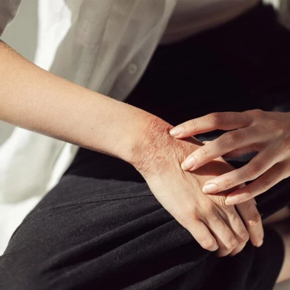 A person examines their forearm, which shows signs of irritation and redness, with one hand gently touching it.